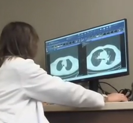 Early cancer detection with AI