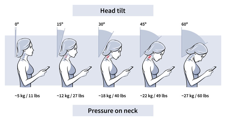 chart shows increasing pressure on neck as head is tilted forward