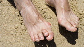 Person on a beach with hammertoe