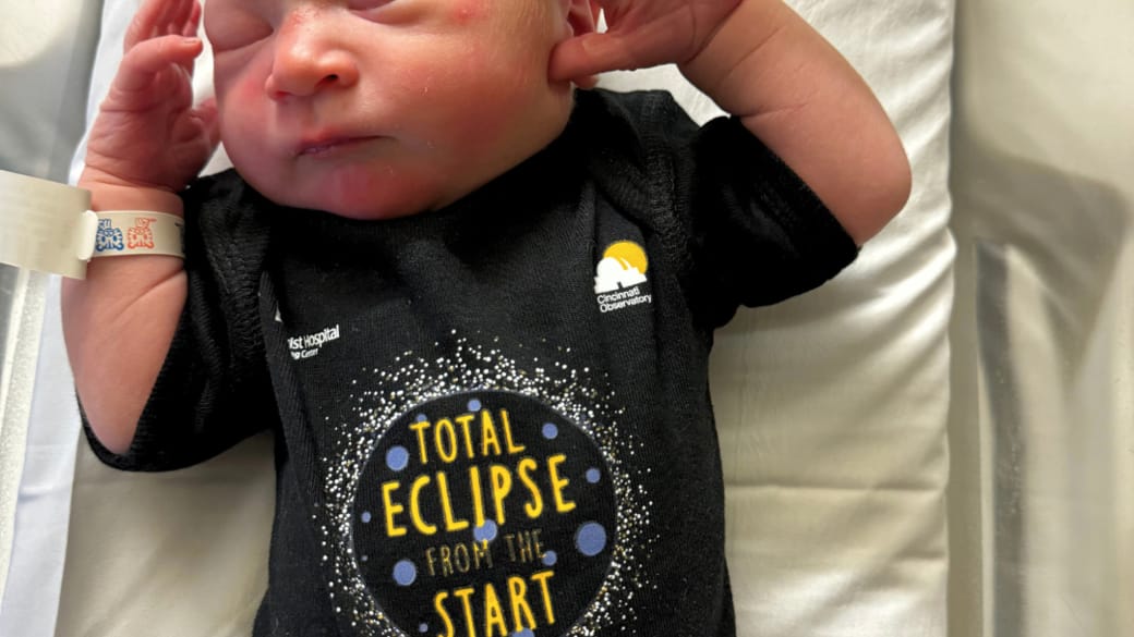 Solar_Eclipse_Onesie