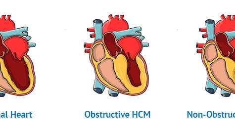 HCM-examples